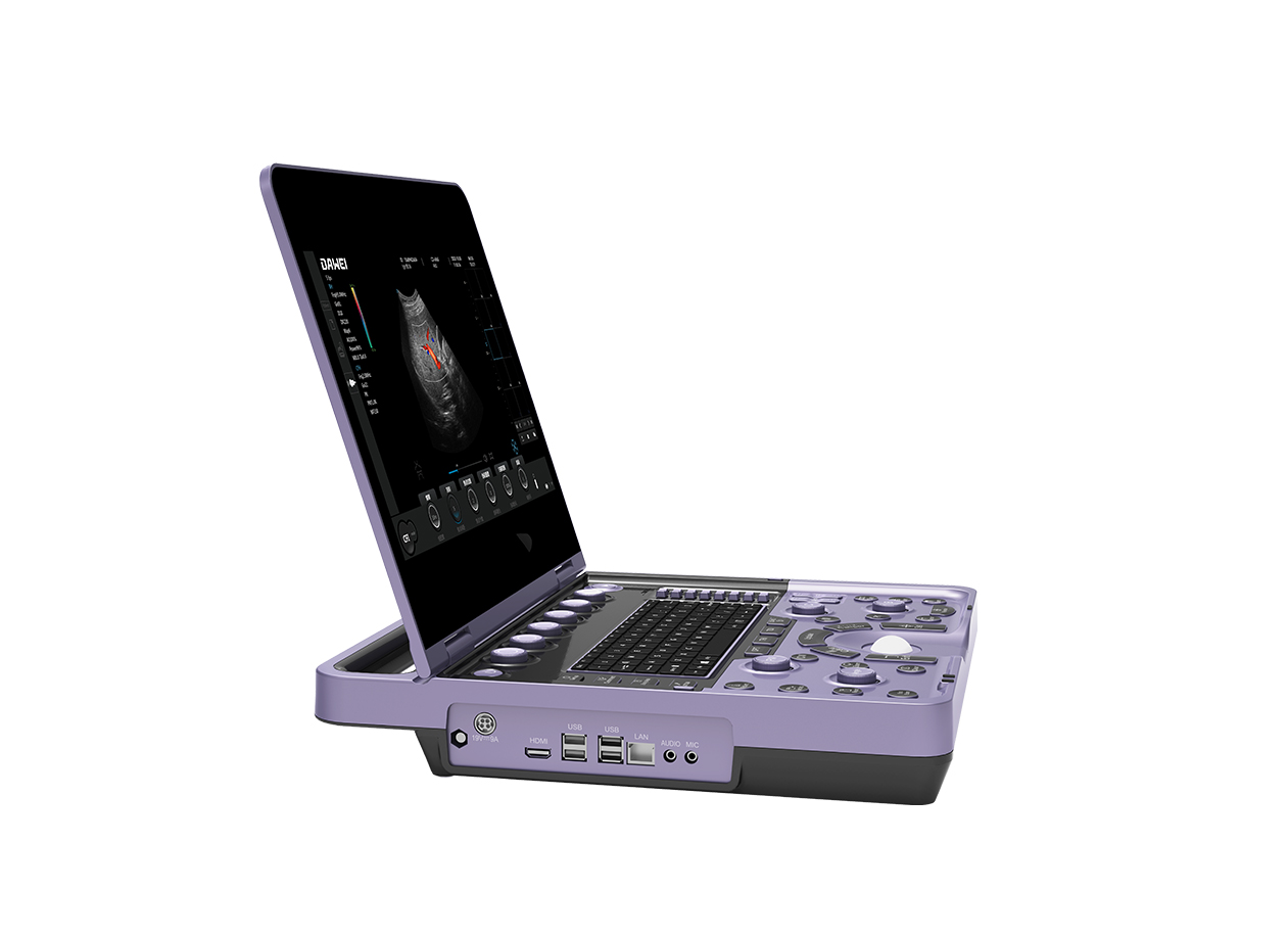 筆記本式彩色多普勒超聲診斷儀