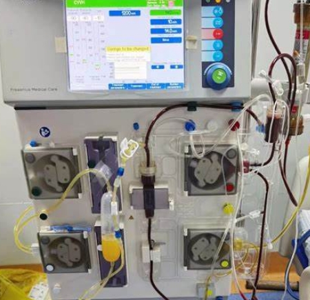 血液透析與濾過的便攜化：為患者提供靈活、高效的治療選擇