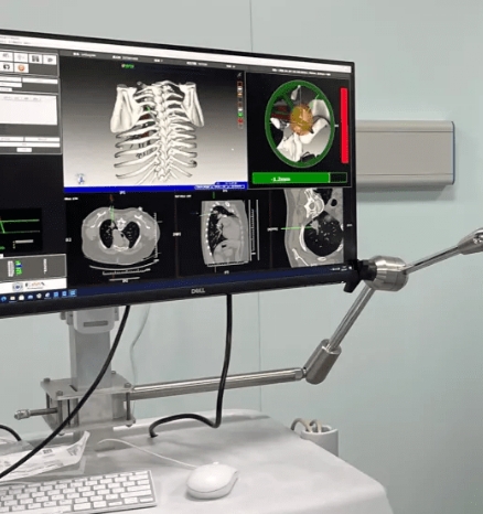 激光手術(shù)導(dǎo)航的便攜時代：精準(zhǔn)定位，引領(lǐng)手術(shù)新潮流