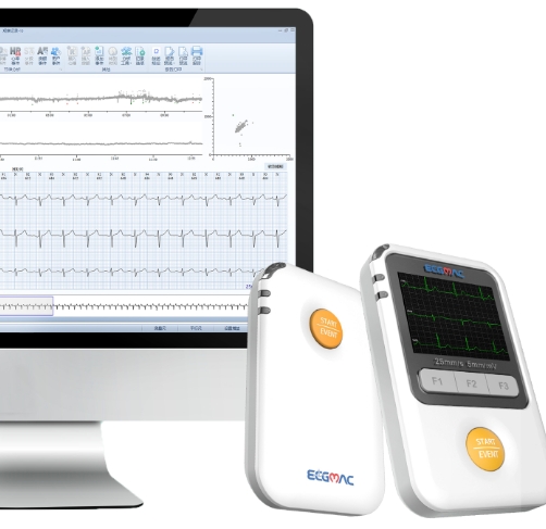 遠程心電監(jiān)測的智能化：精準分析，守護心臟健康