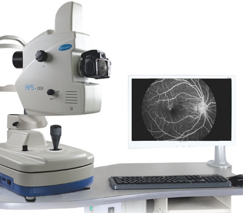 點(diǎn)亮生命色彩：探索最新眼底血管造影技術(shù)的革新應(yīng)用