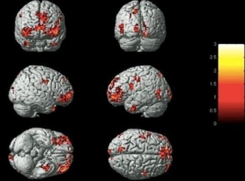 守護(hù)健康，從‘腦’開(kāi)始：揭秘新一代腦功能成像技術(shù)的革新