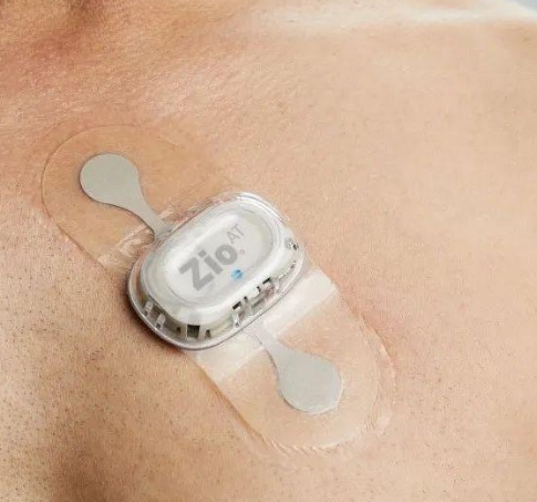 無創(chuàng)心臟監(jiān)測新突破：可穿戴心電監(jiān)護貼的應用與優(yōu)勢