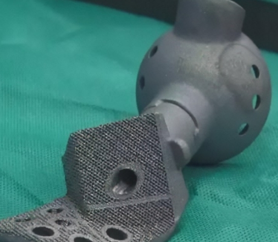 個性化骨科修復(fù)的未來：3D打印定制化關(guān)節(jié)假體的應(yīng)用與發(fā)展