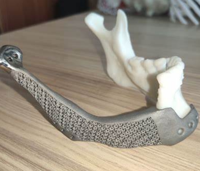 個(gè)性化骨科治療的突破：3D打印骨移植材料的應(yīng)用與發(fā)展