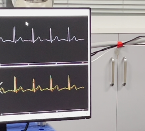 無(wú)創(chuàng)心臟監(jiān)測(cè)新工具：穿戴式心沖擊圖（BCG）設(shè)備全天候監(jiān)控心臟健康