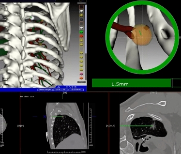精準(zhǔn)手術(shù)導(dǎo)航的新利器：術(shù)中實(shí)時(shí)三維導(dǎo)航影像系統(tǒng)提升手術(shù)精度