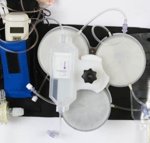 可穿戴式腎透析設備：為患者提供更多的自由和舒適