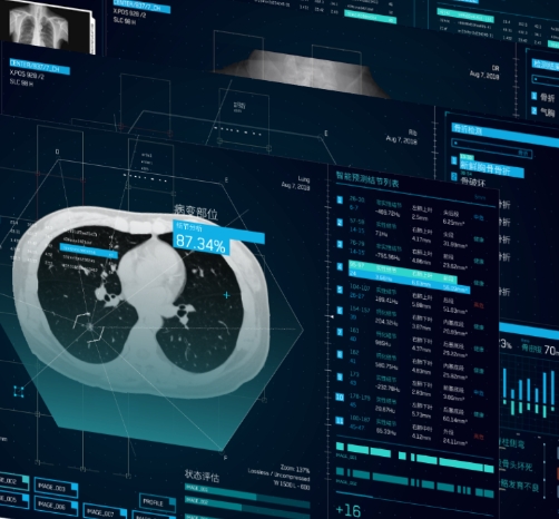 基于AI的影像分析軟件：輔助醫(yī)生做出更準確診斷