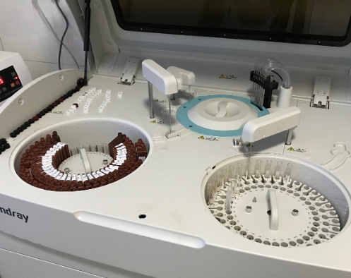 生化指標(biāo)的精準(zhǔn)測量——生化分析儀在代謝性疾病診斷中的價值