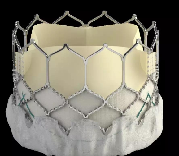 重塑心之門戶——探索人工心臟瓣膜的奇跡