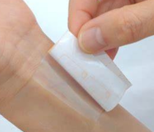 醫(yī)用粘合劑：無縫連接，安心治療——醫(yī)用粘合劑的種類與應(yīng)用