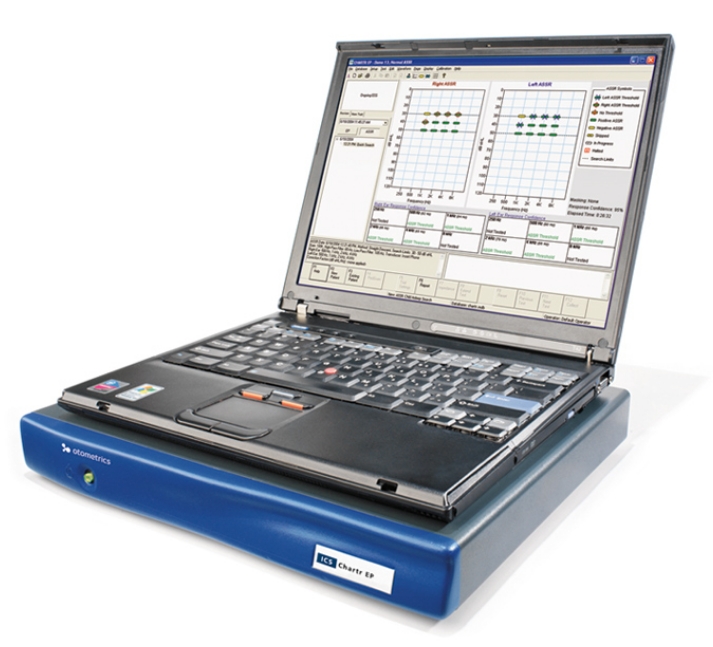 聽覺誘發(fā)電位儀：深入探索聽覺路徑——聽覺誘發(fā)電位儀的技術(shù)特點(diǎn)與應(yīng)用場(chǎng)景