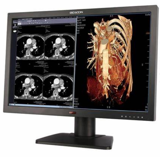 高清顯示，精確診斷——醫(yī)用顯示器的技術(shù)特點(diǎn)及其重要性