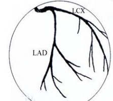 冠狀動脈造影系統(tǒng)