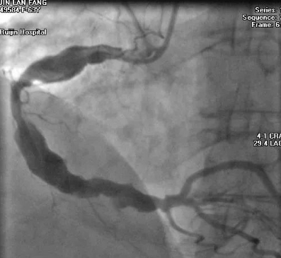 冠脈造影系統(tǒng)?