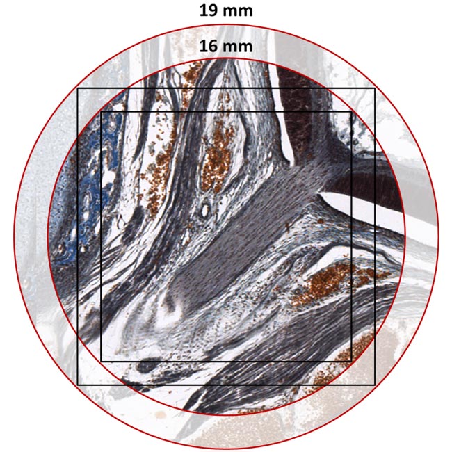 DM4&nbsp;B&nbsp;&&nbsp;DM6&nbsp;B寬視場