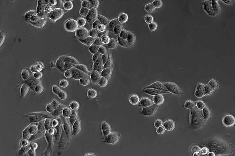 (海拉細胞)放大倍率：20×，相差